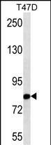 WB - THOC1 Antibody (N-term) AM1950b